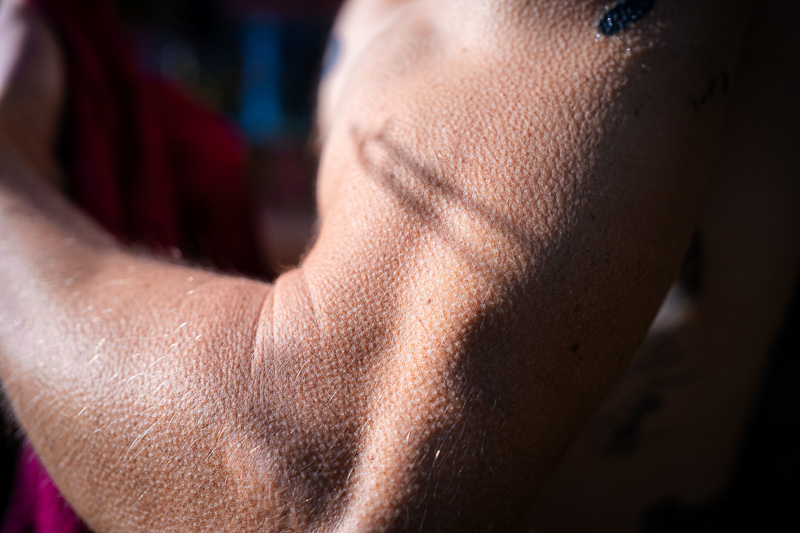 Detail shot of a forearm with goosebumps, showing the visible effect of cold on the skin.