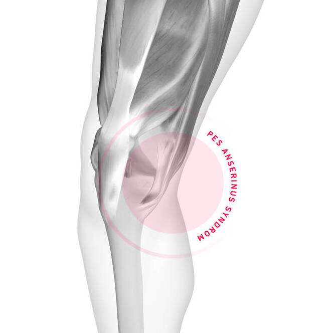 Patellaspitzensyndrom Symptome Therapie Knieschmerzen Beim Laufen Bauerfeind Sports